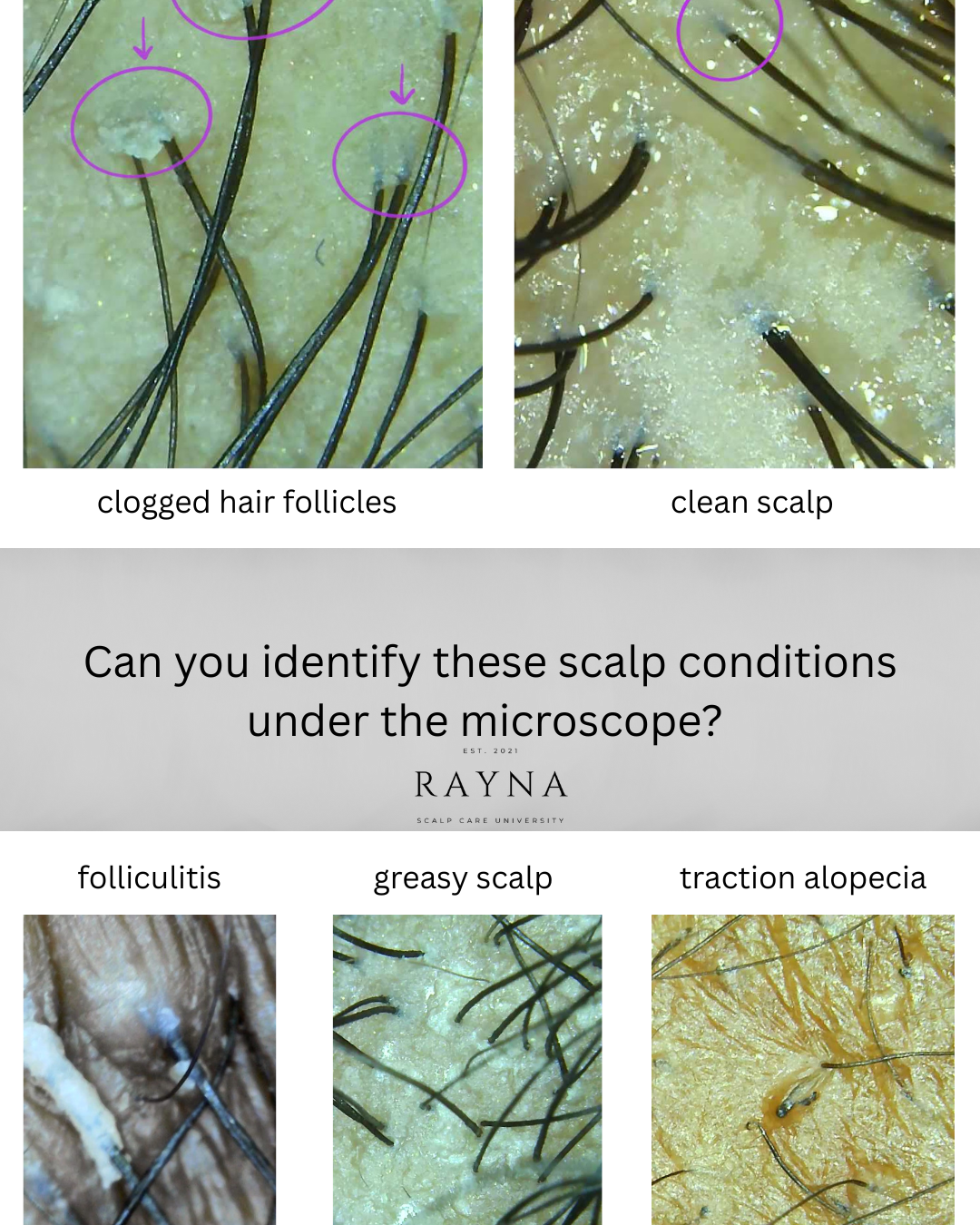 What Is a Hair and Scalp Analysis? Why Healthy Hair Always Starts at the Scalp